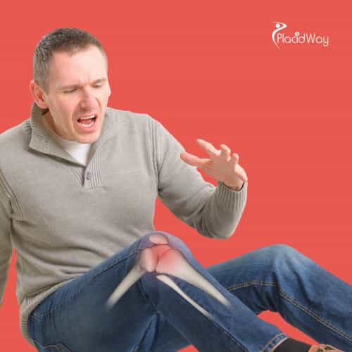 Stem Cell Therapy for Knee Osteoarthritis in Mexico: Brazilian Patient Guide